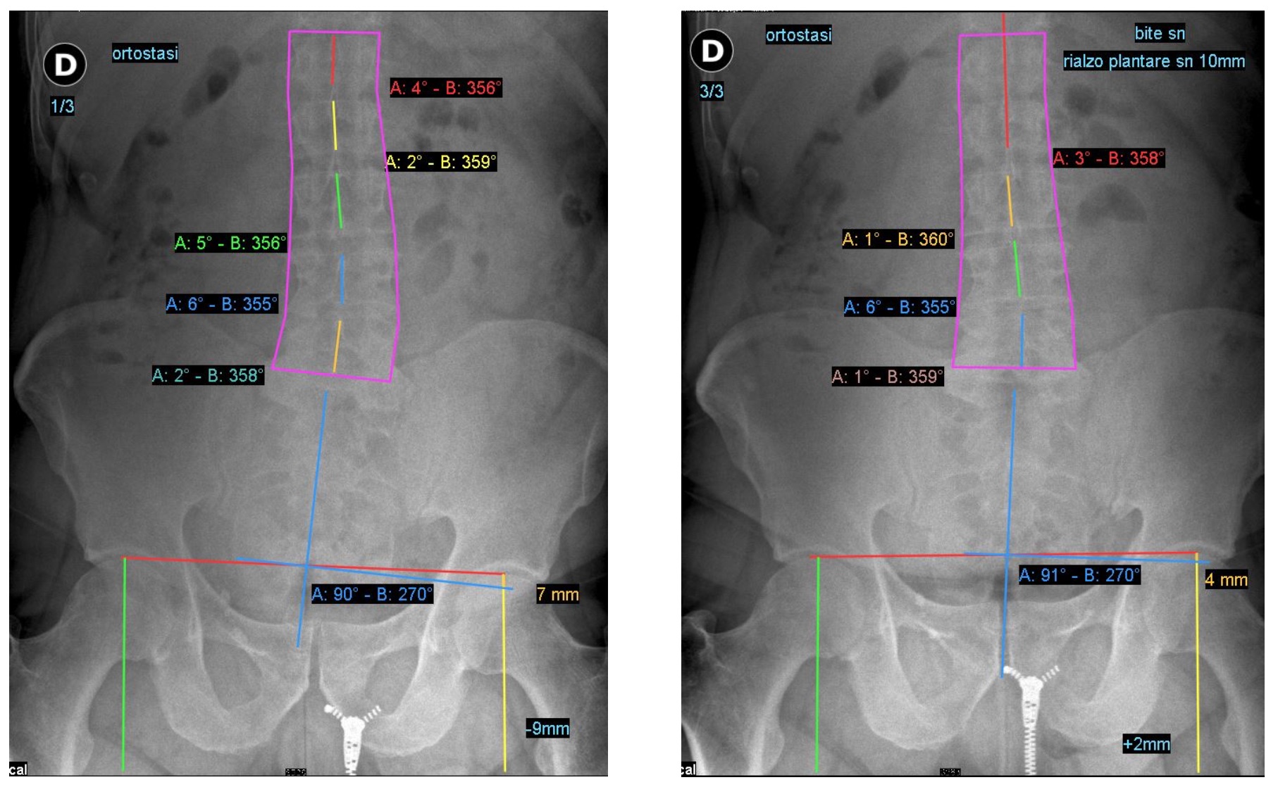 /images/605cf40564a1e98016fdd255-Posture Lab 2.jpg